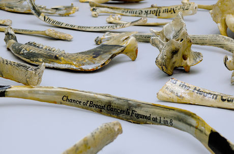 Barbara Hammer, Cancer Bones, 1994