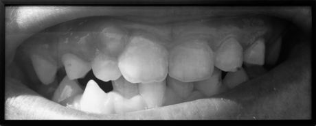 Santiago Sierra, Teeth of the Last Gipsies of Ponticelli, 2008