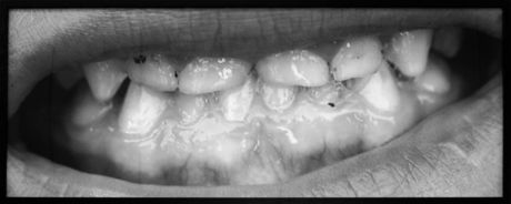 Santiago Sierra, Teeth of the Last Gipsies of Ponticelli, 2008