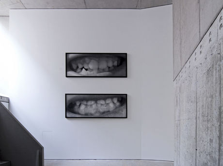 Santiago Sierra, Teeth of the Last Gipsies of Ponticelli, 2008