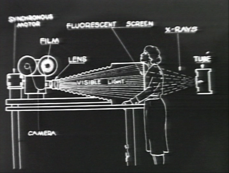 Barbara Hammer, Dr. Watson‘s X-Rays, 1991, video, color, sound, 22 min